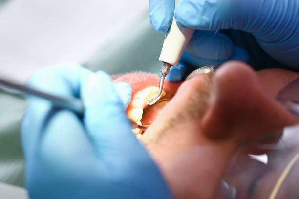 Best Root Canal Emergency Dentist  in Crooks, SD