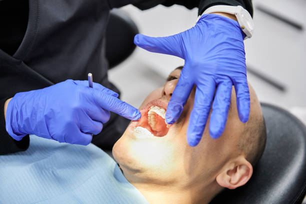 Best Urgent Tooth Repair  in Crooks, SD